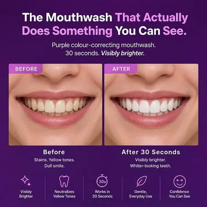 🔥Limited-time "Buy One Get One Free" promotion🔥Purple Mouthwash